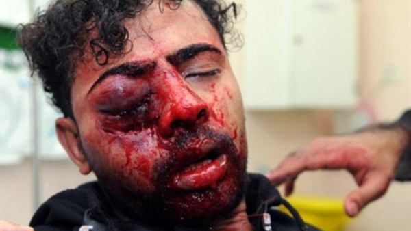 بحريني تعرض لإصابة خلال التظاهرات/أ.ف.ب 