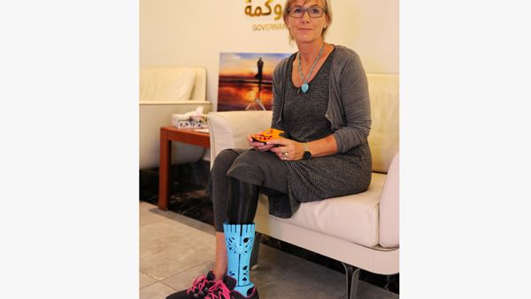 The 3D printed prosthetic leg was donated to Belinda Gatland, a British expat who has been an amputee for more than 10 years. (Trade Arabia) The 3D printed prosthetic leg was donated to Belinda Gatland, a British expat who has been an amputee for more than 10 years. (Trade Arabia)