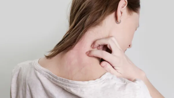 الجلد مرتبط بمجموعة من النهايات العصبية التي تميز الألم (shutterstock.com)
