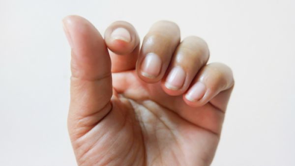 يؤدي التدخين إلى اصفرار الأظافر وفقدانها للحيوية (shutterstock.com)
