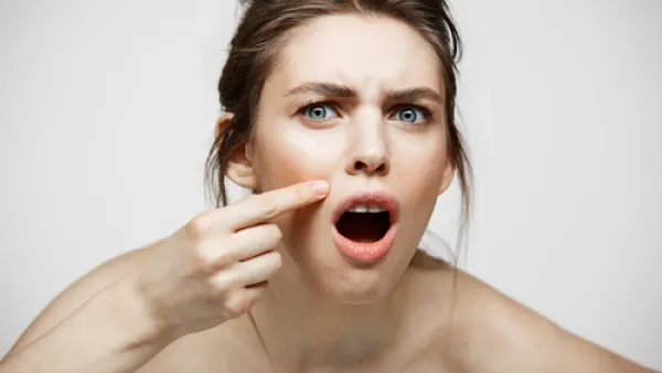 ضعي عصير الليمون على وجهك لبضع دقائق لمحاربة الالتهابات. (shutterstock.com)
