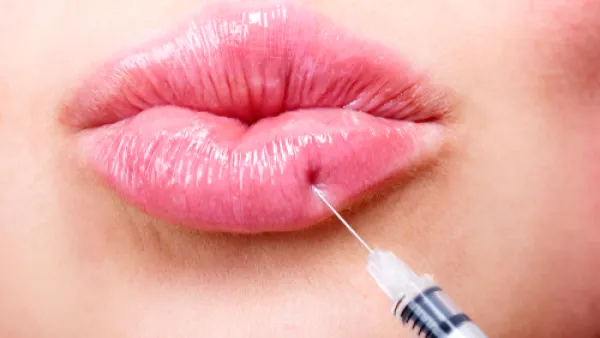 لا تستعملي أحمر شفاه لمدة 24 ساعة على الأقل بعد حقن الفيلر (shutterstock.com)