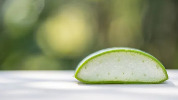 يُستخدم الهلام الداخلي لنبتة الألوفيرا، كعلاج لجميع المشاكل الجلدية (shutterstock.com)