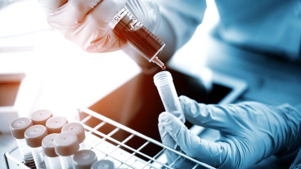 This means patients suffering from cancer, sickle cell anaemia and thalassaemia will no longer have to travel abroad. (Shutterstock)