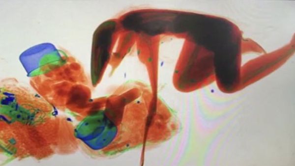 أصرّت امرأة على مرافقة "حقيبتها" ودخول جهاز الفحص بالأشعة السينية 