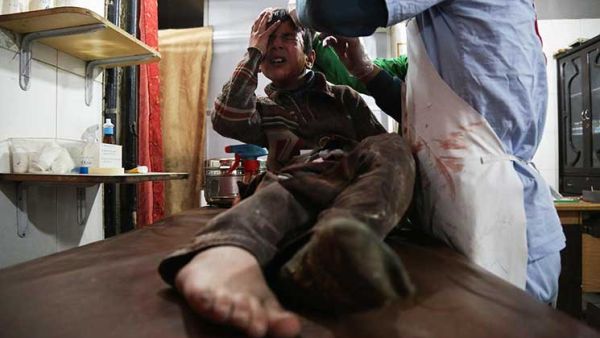 طفل سوري أصيب بجروح جراء القصف العنيف على الغوطة