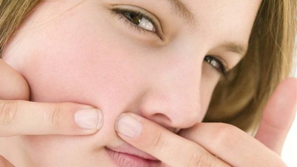 تجنب فرك الحبوب ومحاولة إزالتها بالأظافر