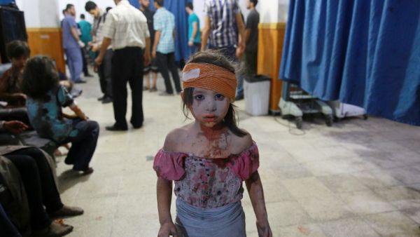 A wounded Syrian girl stands at a makeshift hospital in the rebel-held area of Douma following shelling and air raids by Syrian government forces on Aug. 22, 2015. (AFP/Abed Doumany)