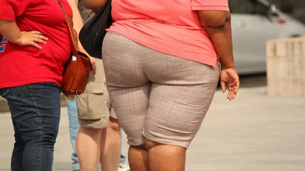 A recent report revealed that 70 percent of men and 75 percent of women suffer from obesity today, which is expected to be responsible for the deaths of over 500,000 people every year. (Pixabay)