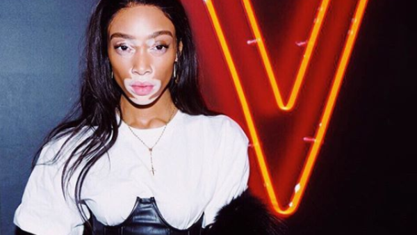 ويني هارلو (instagram.com/winnieharlow)