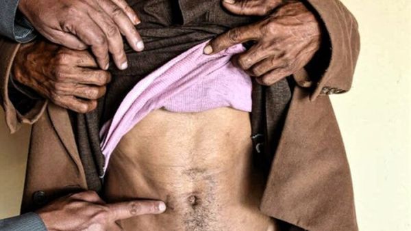 المنظمة اليمنية لمحاربة تجارة الأعضاء وثقت أكثر من ألف حالة تجارة أعضاء منذ سنة 2012