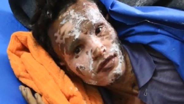 كشفت التقارير الطبية عن استقبال حالات عليها اعراض غريبة نتيجة الأسلحة المحظورة

