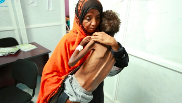  أكثر من 6 آلاف طفل قتلوا أو أصيبوا بجروح خطرة منذ بدء الحرب عام 2015