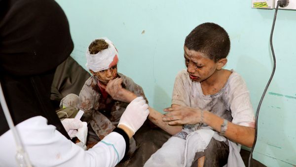 مقتل 50 شخصا وإصابة 77 آخرين معظمهم أطفال عبر استهدافهم بطائرات التحالف في صعدة