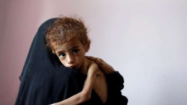 برنامج الأغذية العالمي يغذي حاليا حوالي 8 ملايين شخص شهريا في اليمن