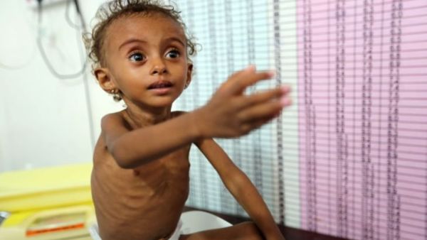الأمم المتحدة تحذر من تعرض نحو 14 مليون يمني للمجاعة