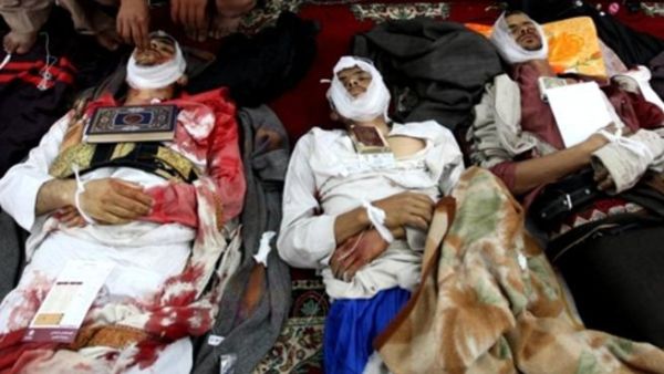مقتل 48 شخصا من المحتجين في ساحة التغيير بجامعة صنعاء 