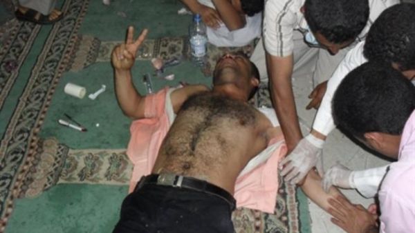 أحد مصابي مواجهات صنعاء