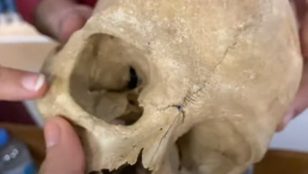 عطاء لشراء جثث بشرية بالظرف المختوم