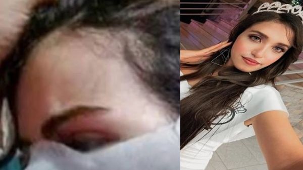 جار ملكة جمال النيل يمزق وجهها بالمشرط