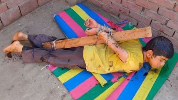 مصري يطلي طفله بالعسل ويتركه فريسة للحشرات عقابا على السرقة