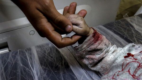 A man holds the hand of Maria al-Gazali, a Palestinian baby, as her body lies on a stretcher at a hospital in Beit Lahia, in northern Gaza Strip  (AFP)