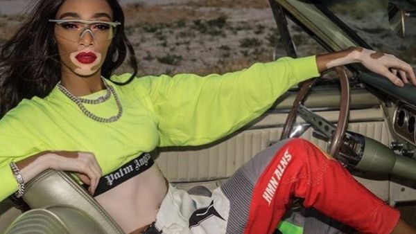 Winnie Harlow (Twitter)