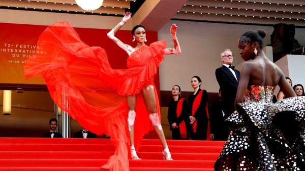 Winnie Harlow (Twitter)