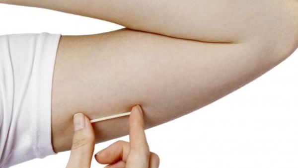 هل يمكن حدوث حمل مع وجود شريحة منع الحمل
