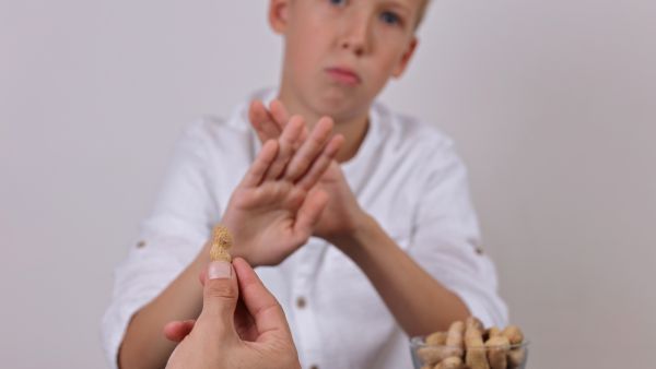 حساسية الفول السوداني عند الأطفال