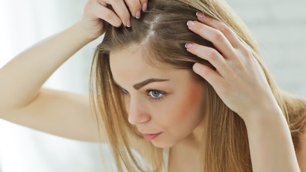 تعتبر الصدفية مرضًا مزمنًا يمكن أن يستمر طويلاً وهو أكثر تقشراً
