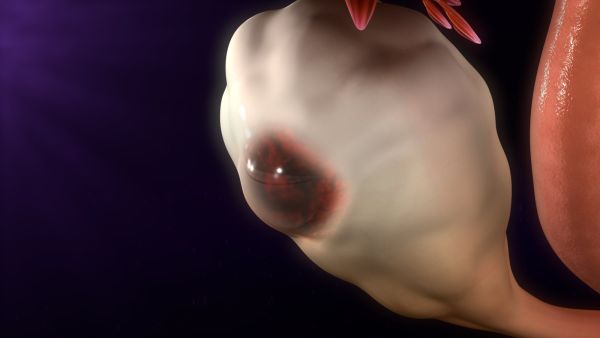 تصيب أكياس الشوكولاتة من هم في عمر 20-40 سنة بنسبة أكبر