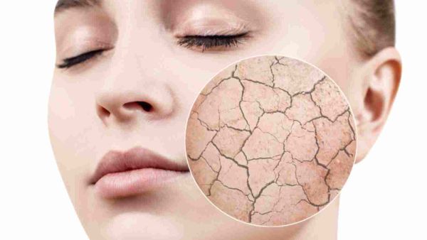 قبل وضع المكياج يجب تعقيم البشرة وذلك بهدف التخلُّص من خلايا الجلد الميتة