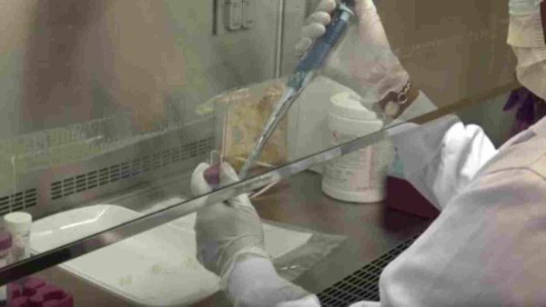 يسعى الباحثون إلى استخدام زراعة الفضلات البشرية كعلاج لمحاربة "الميلانوما" أو "الورم الميلاني"