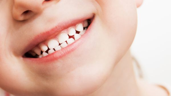 اللبن وجبة خفيفة لمنع تسوس الأسنان فهو ملئ بالكالسيوم