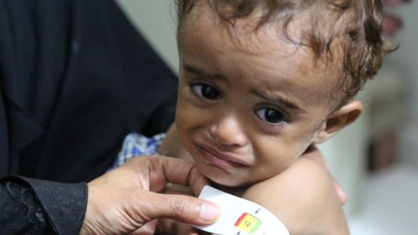  تغذية الأطفال في منطقة الشرق الأوسط وشمال إفريقيا منذ عام 2000 تسوء