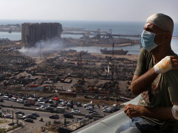 Lebanese TV producer Tony Ahwaji sits injured on the balcony of his damaged apartment in the damaged neighbourhood of Mar Mikhael in the Lebanese capital Beirut on August 6, 2020, two days after a massive explosion shook the Lebanese capital. The blast, which appeared to have been caused by a fire igniting 2,750 tonnes of ammonium nitrate left unsecured in a warehouse, was felt as far away as Cyprus, some 150 miles (240 kilometres) to the northwest. The scale of the destruction was such that the Lebanese ca