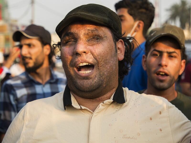 An Iraqi protestor wounded in war shouts slogans during a demonstration against state corruption, failing public services and unemployment, on October 2, 2019 in the southern city of Basra. Popular protests multiplied across Iraq today as thousands of demonstrators braved live fire and tear gas in rallies that have left seven dead in the past 24 hours. Hussein FALEH / AFP
