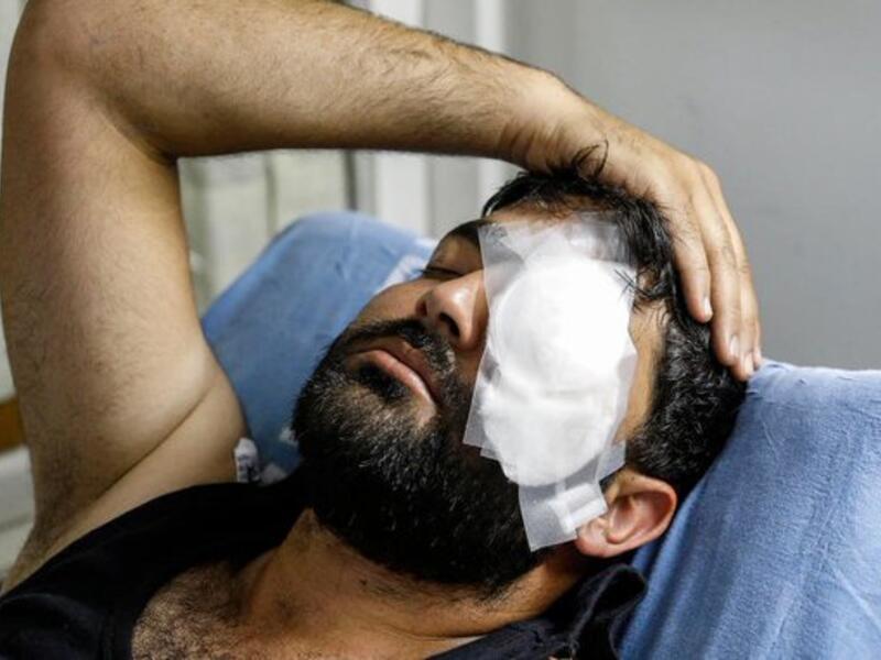 Palestinian photojournalist Muath Amarneh lost his left eye yesterday by Israeli sniper fire while covering protests in Surif near Al-Khalil (Hebron)(Twitter)