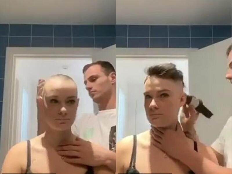 Eva Barilaro, from Monaco, has alopecia and asked her firefighter boyfriend Damien Fabre, 26, to shave her head after her hair began falling out in May. (TikTok/Eva Barilaro)