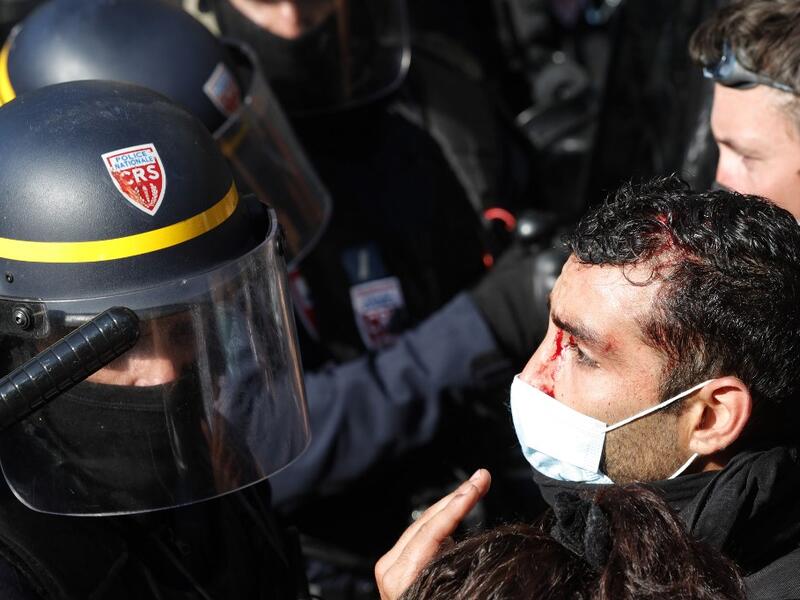 A man, with a slight head injury, confronts French riot police during a demonstration called by the "yellow vest" (Gilets Jaunes) movement in the French capital Paris on September 12, 2020. It is not clear how the protester was injured. GEOFFROY VAN DER HASSELT / AFP