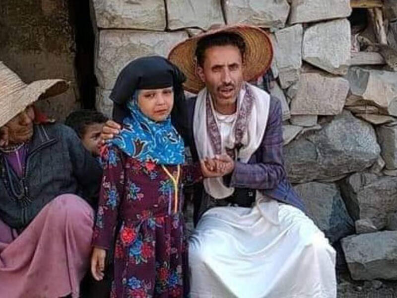 يمني يبيع طفلته