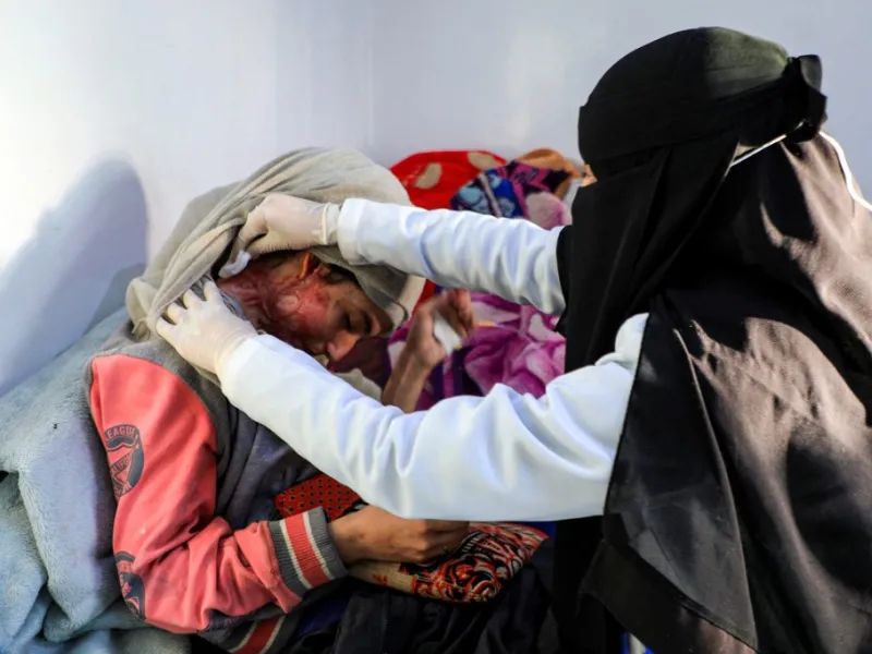 Al-Anoud Hussain Sheryan, a 19-year-old girl disfigured in an acid attack by her abusive husband, sits at a hospital where she is undergoing treatment in Yemen's capital Sanaa on January 28, 2021 as a woman unwraps her veil to show her injuries. Married at the age of 12, rejected at 16, and then disfigured in an acid attack, Sheryan's fate is a shocking illustration of abuse in a society beset by war and poverty. Now aged 19, the young Yemeni woman agreed to relate her ordeal at the hands of her abusive hus