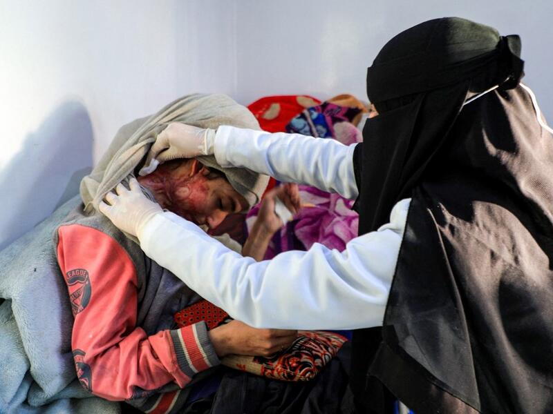 Al-Anoud Hussain Sheryan, a 19-year-old girl disfigured in an acid attack by her abusive husband, sits at a hospital where she is undergoing treatment in Yemen's capital Sanaa on January 28, 2021 as a woman unwraps her veil to show her injuries. Married at the age of 12, rejected at 16, and then disfigured in an acid attack, Sheryan's fate is a shocking illustration of abuse in a society beset by war and poverty. Now aged 19, the young Yemeni woman agreed to relate her ordeal at the hands of her abusive hus