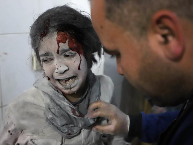  Syrian girl receives treatment as victims of reported regime air strikes 