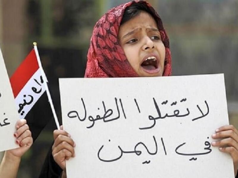 منظمة: الأطفال اليمنيون ما زالوا يموتون من الجوع