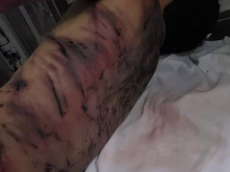 Syria's Bashar Abd Al Saud, tortured to death