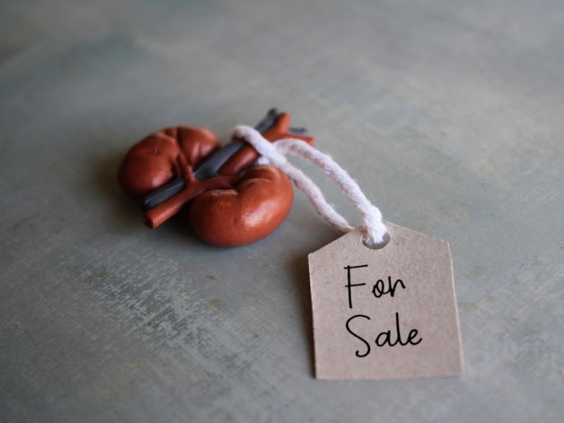 Iraqi man lures son and sells his kidney