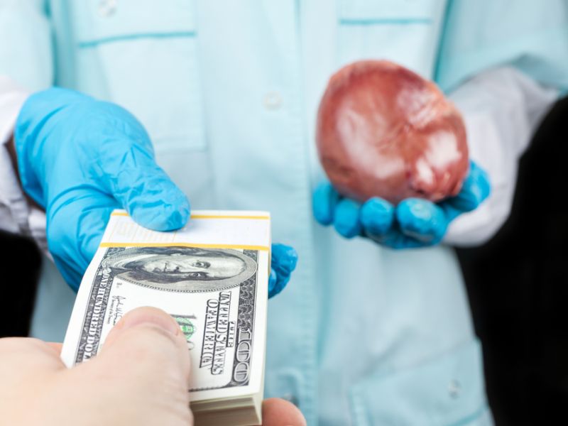 Organs