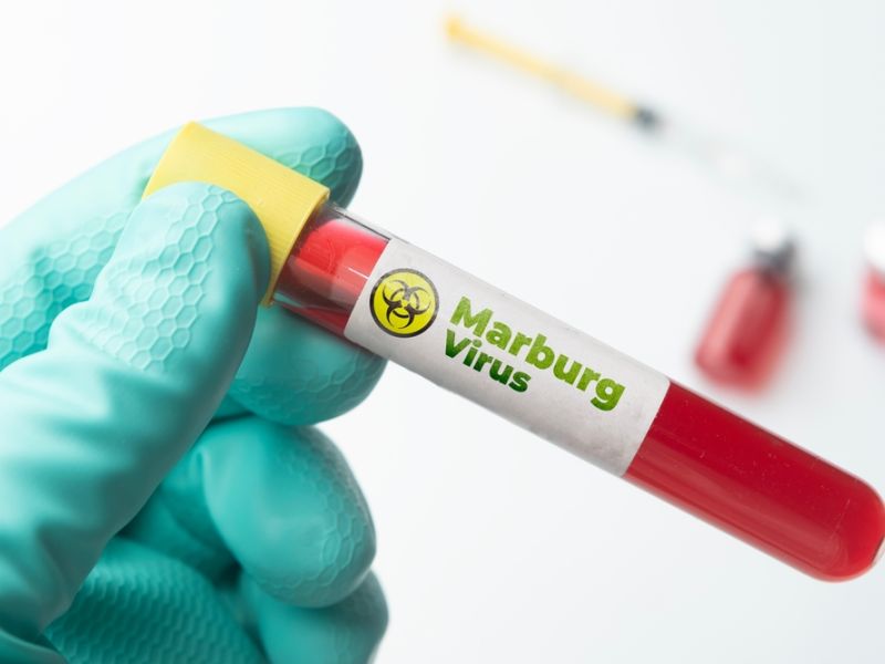 Marburg virus